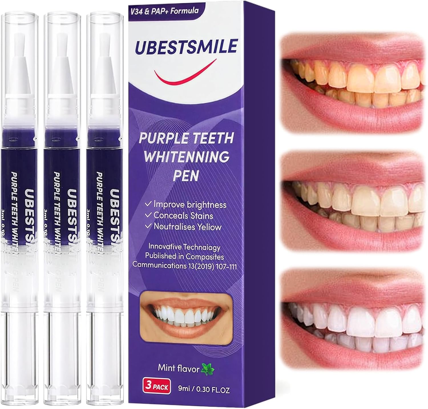 UBESTSMILE V34&PAP+ Фиолетовый – обзор и цена Teeth Whitening Kit