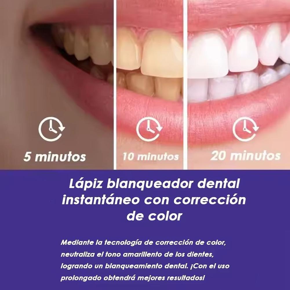 UBESTSMILE V34&PAP+ Фиолетовый – обзор и цена Teeth Whitening Kit