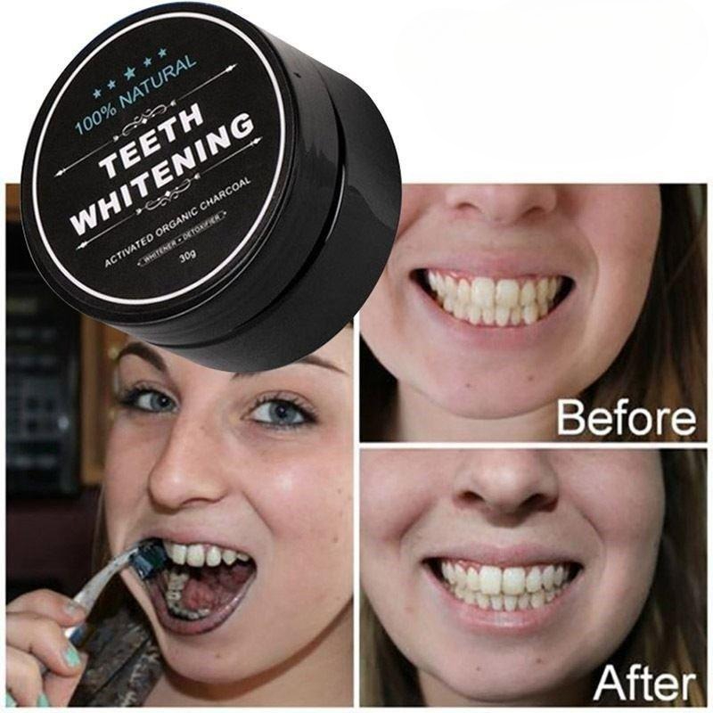 1 коробка порошка для отбелива – обзор и цена Teeth Whitening Pens